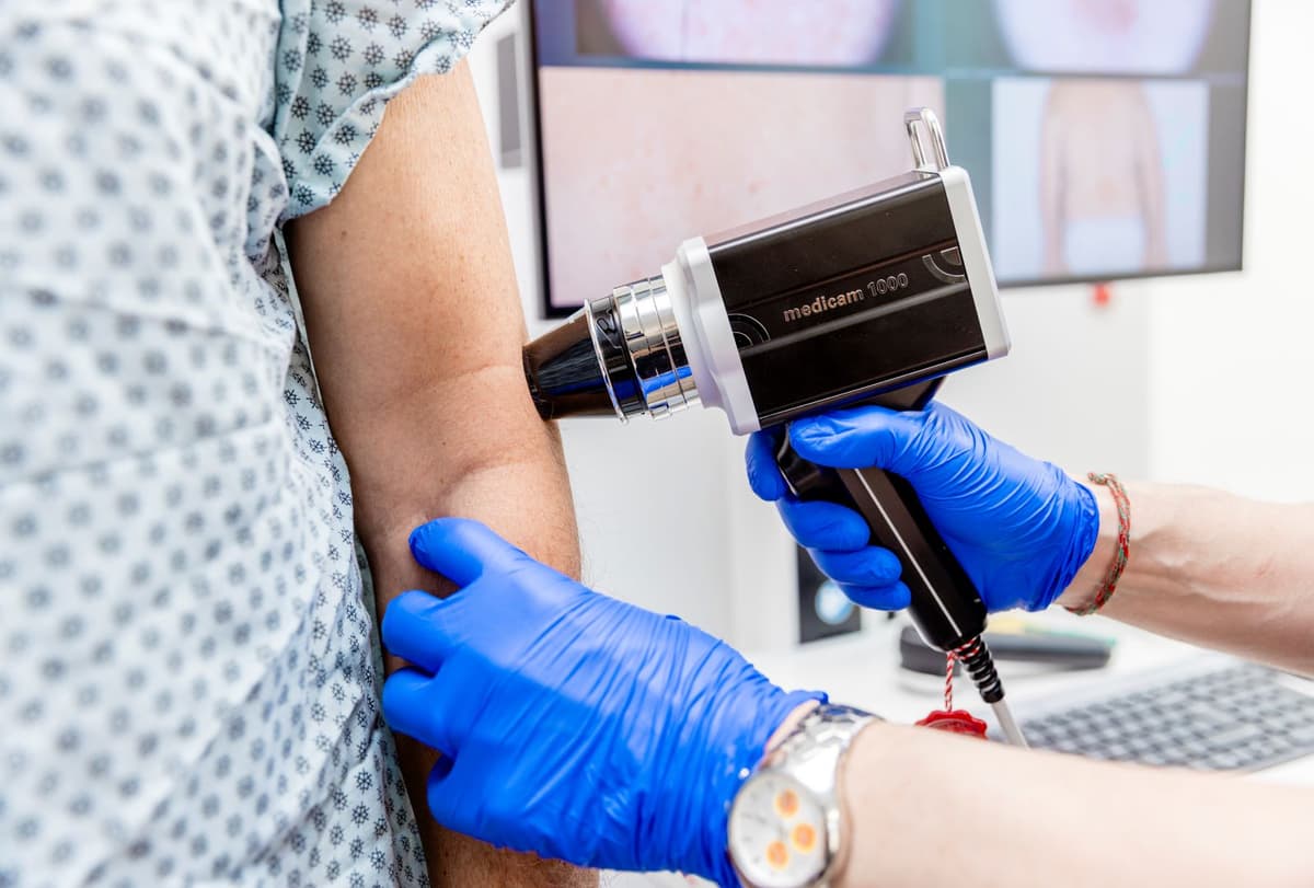 Image of FotoFinder machine that is used for targeted dermoscopy